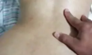 ಗುದ ಮುಂಚಾಚಿರುವಿಕೆಯಲ್ ...