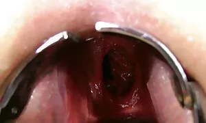 ಡಬಲ್ ಗುದ ಮುಷ್ಟಿ, ಸರಿ ...